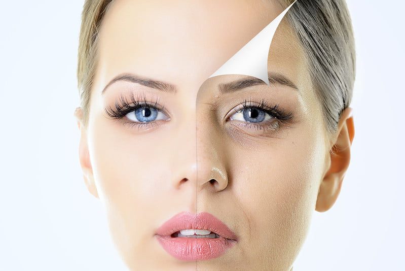 beautiful skin, younger looking skin